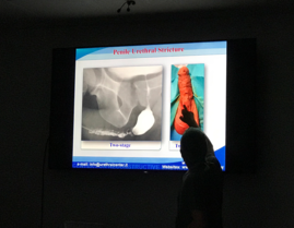 El Dr. G Barbagli en su presentación sobre la cirugía uretral