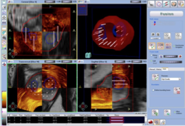 Imagen del proceso de biopsia